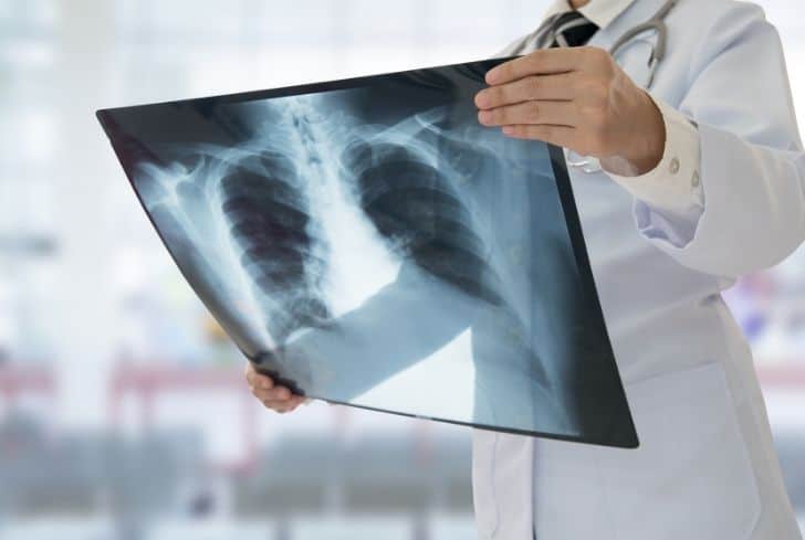 醫(yī)療廢物X射線報(bào)告銷毀 醫(yī)療廢物X射線報(bào)告銷毀